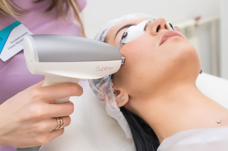 perform a procedure for skin rejuvenation with the laser